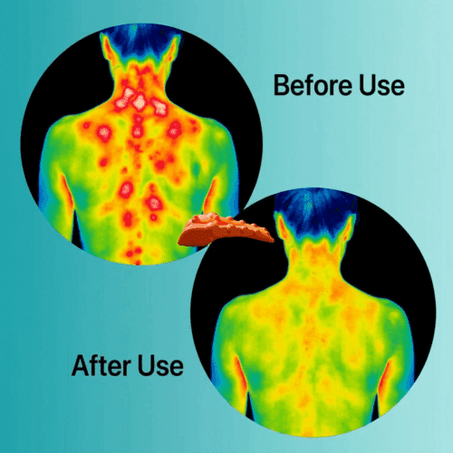 CerviPoint Trigger Point Massager (Official Retailer) [year]